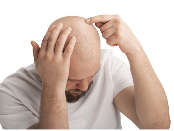 Bald Men and Head Lice: Debunking Myths and Understanding Risks